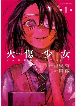 Yakedo Shoujo